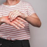 raynaud
