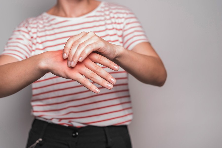 raynaud
