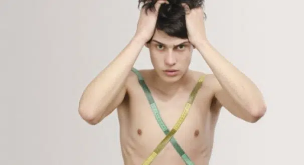 anorexia